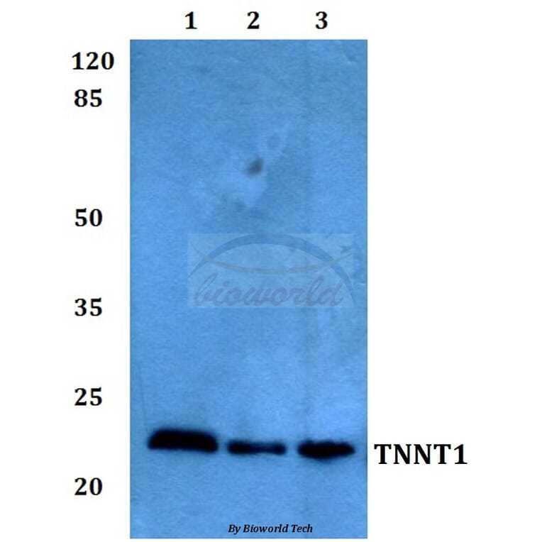 Anti-Troponin T1 Antibody from Bioworld Technology (BS60260) - Antibodies.com