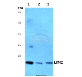 Anti-LSM2 Antibody from Bioworld Technology (BS60261) - Antibodies.com