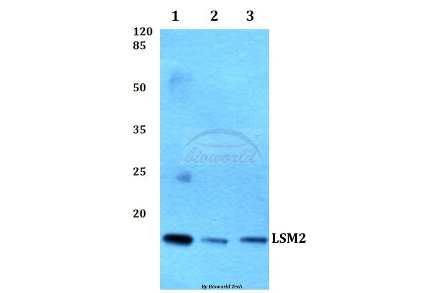 Anti-LSM2 Antibody from Bioworld Technology (BS60261) - Antibodies.com