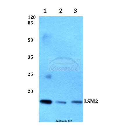 Anti-LSM2 Antibody from Bioworld Technology (BS60261) - Antibodies.com