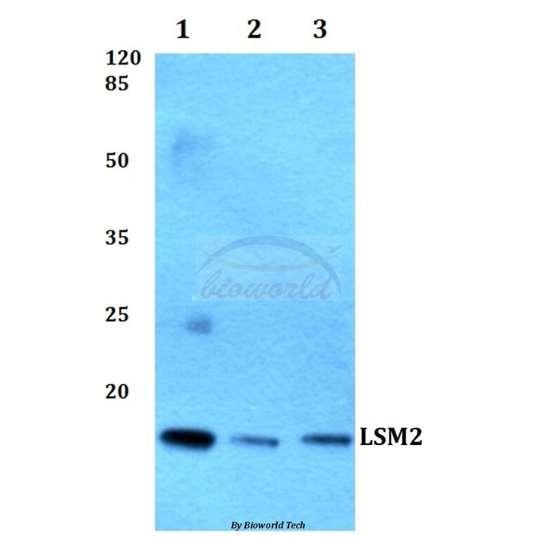 Anti-LSM2 Antibody from Bioworld Technology (BS60261) - Antibodies.com