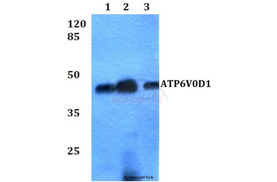 Anti-ATP6V0D1 Antibody from Bioworld Technology (BS60264) - Antibodies.com