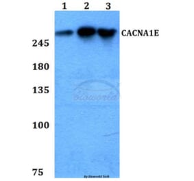 Anti-CACNA1E Antibody from Bioworld Technology (BS60267) - Antibodies.com