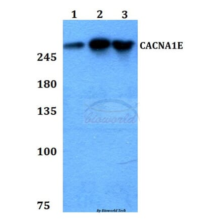 Anti-CACNA1E Antibody from Bioworld Technology (BS60267) - Antibodies.com