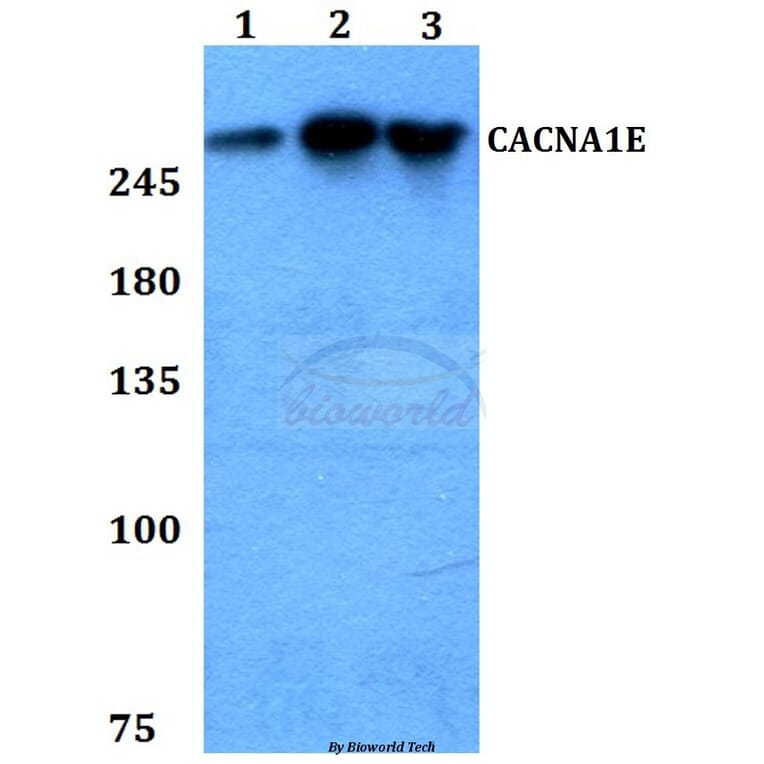 Anti-CACNA1E Antibody from Bioworld Technology (BS60267) - Antibodies.com