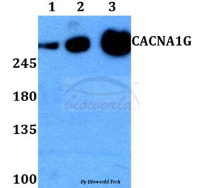 Anti-CACNA1G Antibody from Bioworld Technology (BS60268) - Antibodies.com