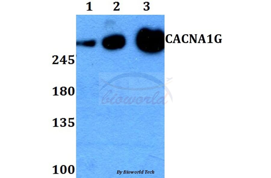 Anti-CACNA1G Antibody from Bioworld Technology (BS60268) - Antibodies.com