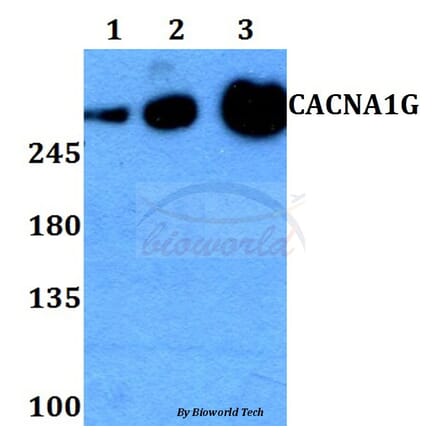 Anti-CACNA1G Antibody from Bioworld Technology (BS60268) - Antibodies.com
