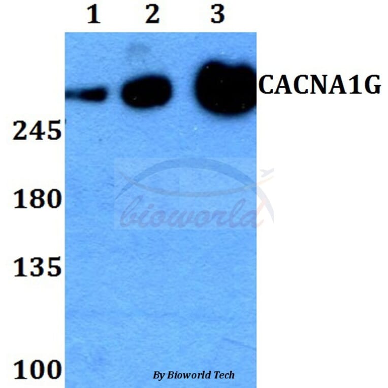 Anti-CACNA1G Antibody from Bioworld Technology (BS60268) - Antibodies.com