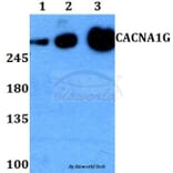 Anti-CACNA1G Antibody from Bioworld Technology (BS60268) - Antibodies.com