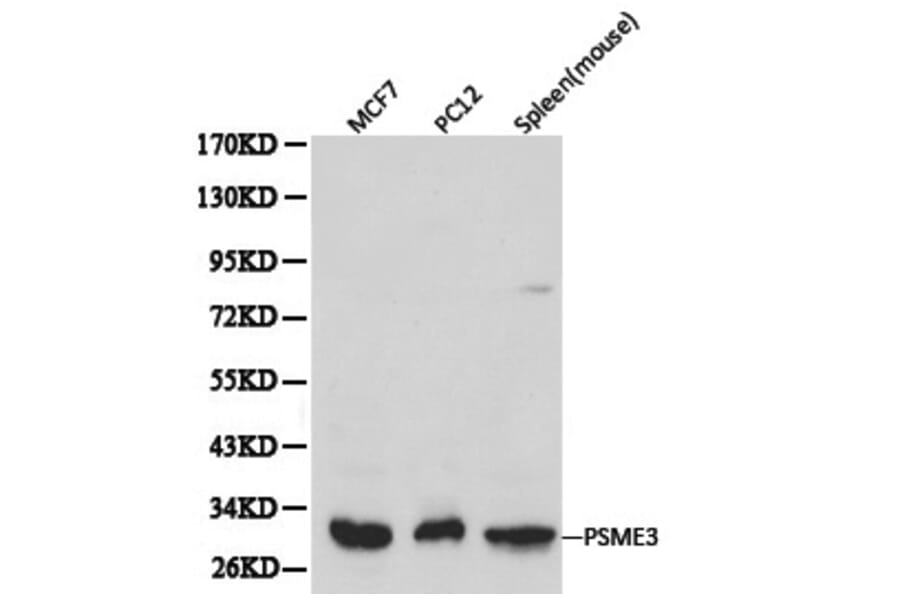 Anti-PSME3 Antibody from Bioworld Technology (BS6027) - Antibodies.com