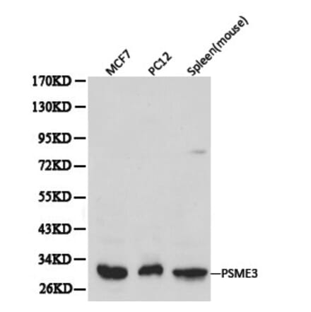 Anti-PSME3 Antibody from Bioworld Technology (BS6027) - Antibodies.com