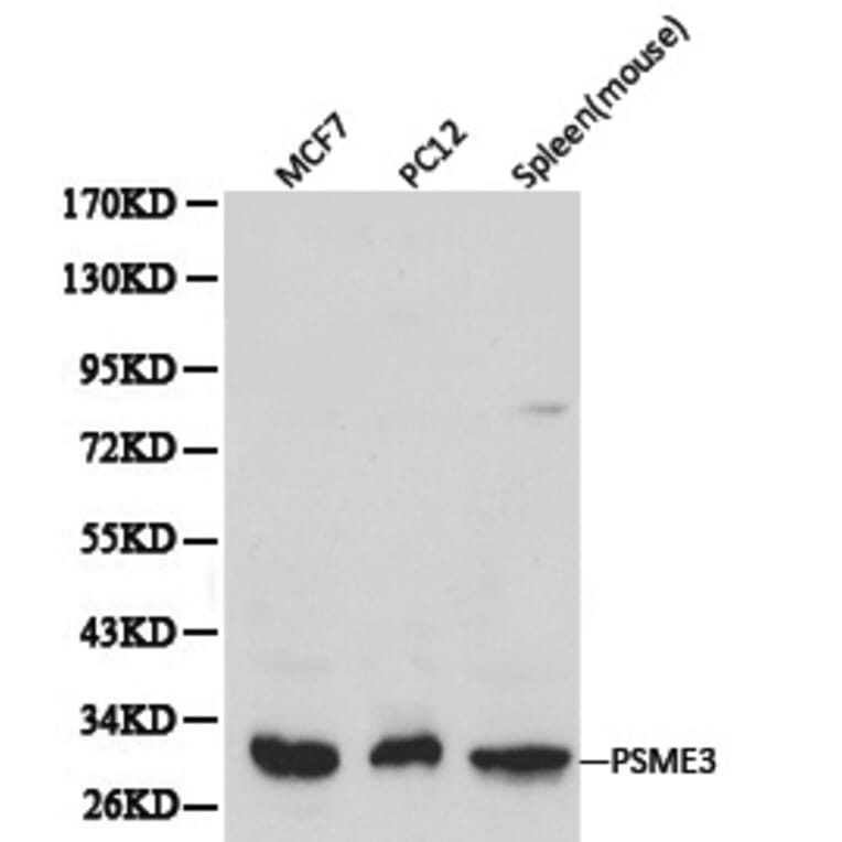 Anti-PSME3 Antibody from Bioworld Technology (BS6027) - Antibodies.com