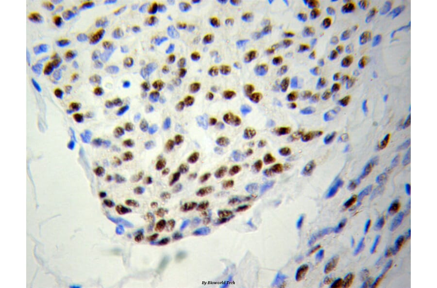 Anti-PSME3 Antibody from Bioworld Technology (BS6027) - Antibodies.com