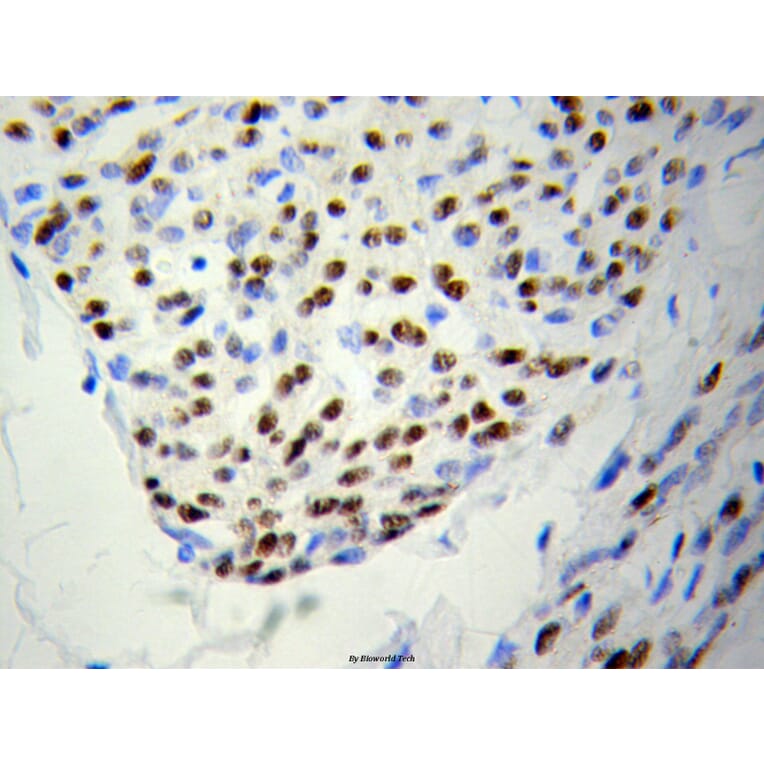 Anti-PSME3 Antibody from Bioworld Technology (BS6027) - Antibodies.com