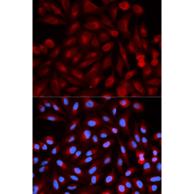 Anti-PSME3 Antibody from Bioworld Technology (BS6027) - Antibodies.com