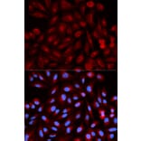 Anti-PSME3 Antibody from Bioworld Technology (BS6027) - Antibodies.com