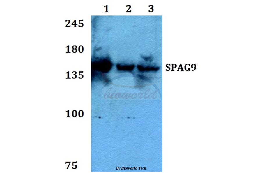 Anti-SPAG9 Antibody from Bioworld Technology (BS60271) - Antibodies.com