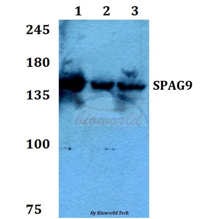 Anti-SPAG9 Antibody from Bioworld Technology (BS60271) - Antibodies.com