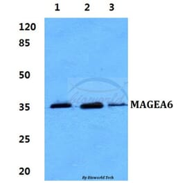 Anti-MAGEA6 Antibody from Bioworld Technology (BS60272) - Antibodies.com