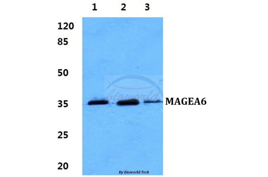 Anti-MAGEA6 Antibody from Bioworld Technology (BS60272) - Antibodies.com