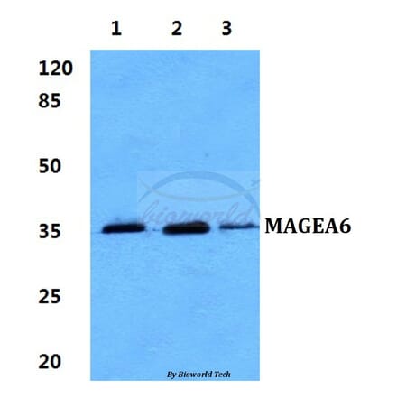 Anti-MAGEA6 Antibody from Bioworld Technology (BS60272) - Antibodies.com