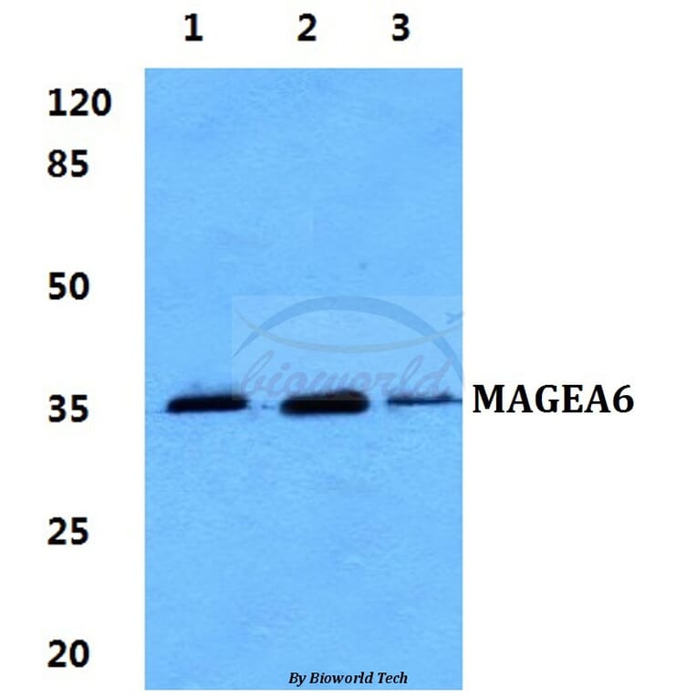 Anti-MAGEA6 Antibody from Bioworld Technology (BS60272) - Antibodies.com