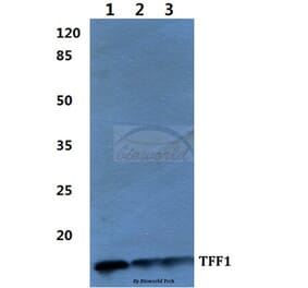 Anti-TFF1 Antibody from Bioworld Technology (BS60275) - Antibodies.com