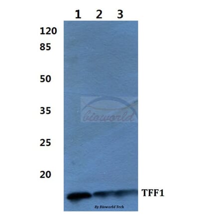 Anti-TFF1 Antibody from Bioworld Technology (BS60275) - Antibodies.com