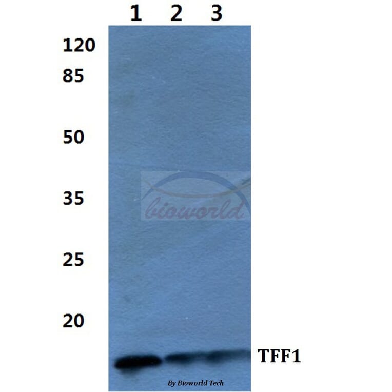 Anti-TFF1 Antibody from Bioworld Technology (BS60275) - Antibodies.com