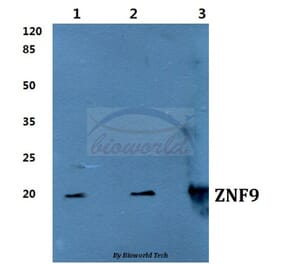 Anti-ZNF9 Antibody from Bioworld Technology (BS60276) - Antibodies.com
