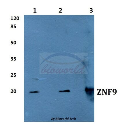 Anti-ZNF9 Antibody from Bioworld Technology (BS60276) - Antibodies.com