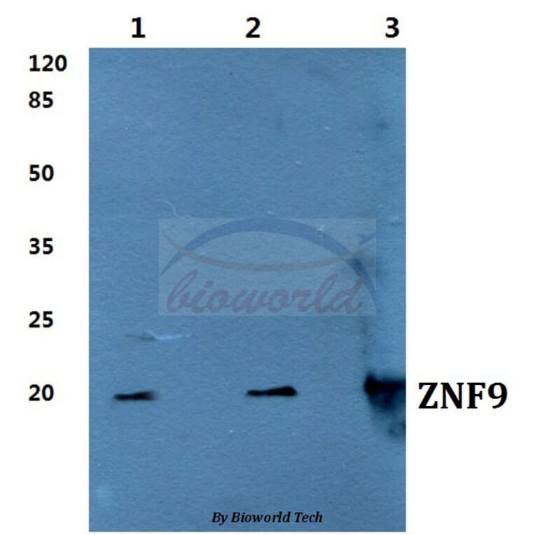 Anti-ZNF9 Antibody from Bioworld Technology (BS60276) - Antibodies.com