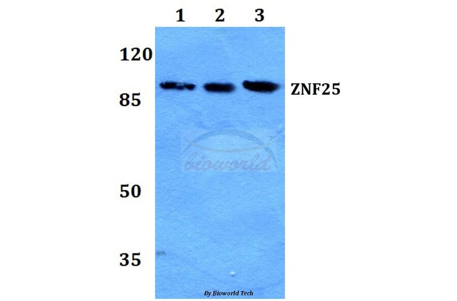 Anti-ZNF25 Antibody from Bioworld Technology (BS60277) - Antibodies.com