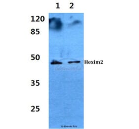 Anti-Hexim2 Antibody from Bioworld Technology (BS60281) - Antibodies.com