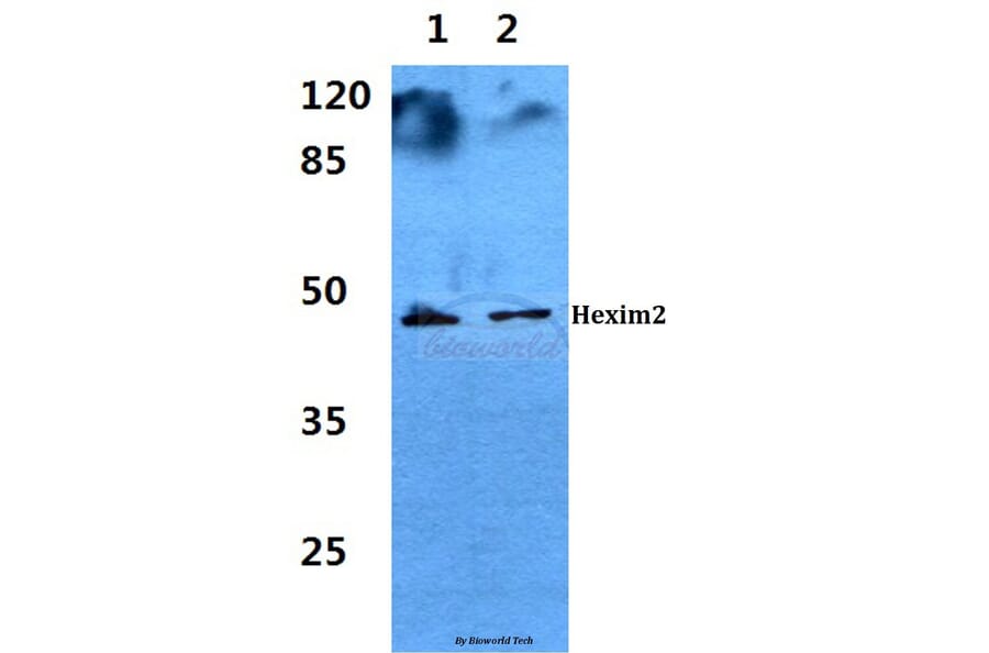 Anti-Hexim2 Antibody from Bioworld Technology (BS60281) - Antibodies.com