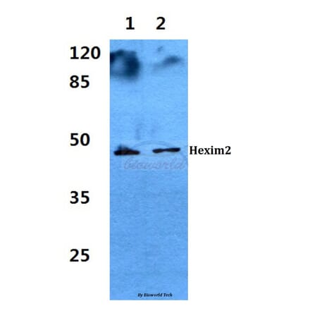 Anti-Hexim2 Antibody from Bioworld Technology (BS60281) - Antibodies.com