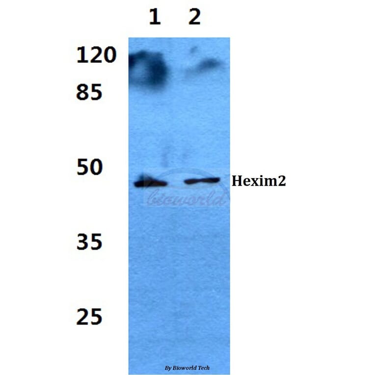 Anti-Hexim2 Antibody from Bioworld Technology (BS60281) - Antibodies.com