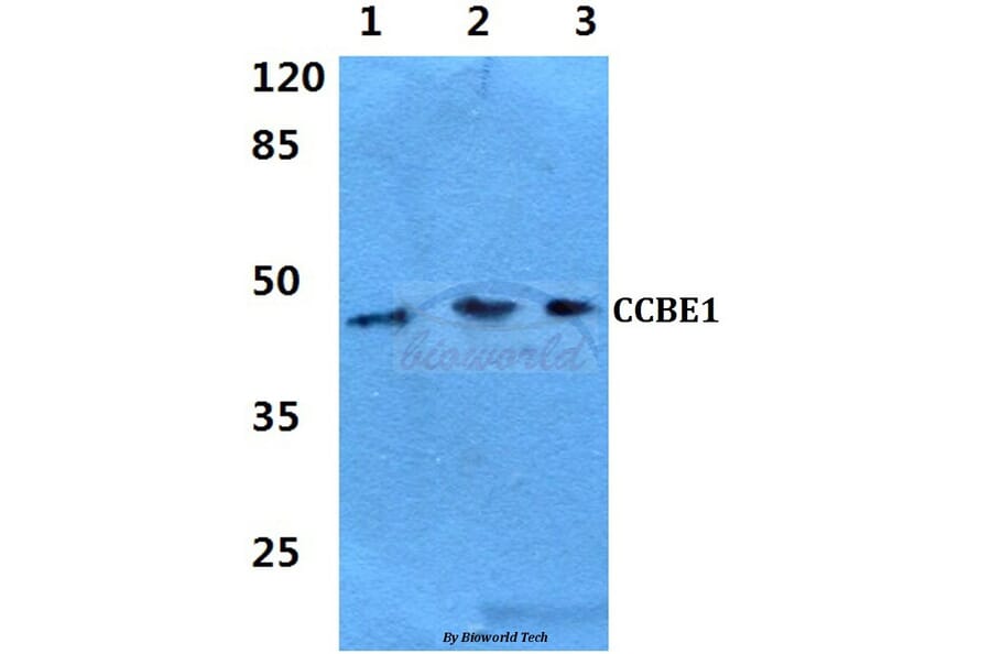 Anti-CCBE1 Antibody from Bioworld Technology (BS60287) - Antibodies.com