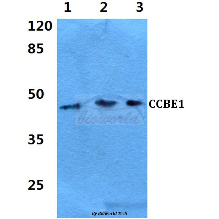 Anti-CCBE1 Antibody from Bioworld Technology (BS60287) - Antibodies.com