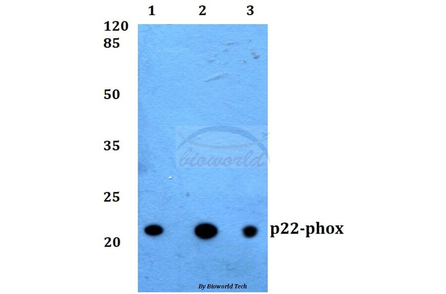 Anti-p22-phox Antibody from Bioworld Technology (BS60290) - Antibodies.com