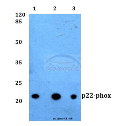 Anti-p22-phox Antibody from Bioworld Technology (BS60290) - Antibodies.com