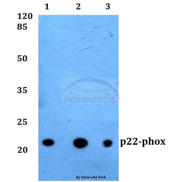 Anti-p22-phox Antibody from Bioworld Technology (BS60290) - Antibodies.com