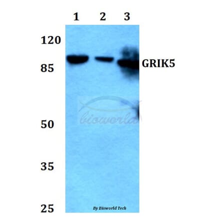 Anti-GRIK5 Antibody from Bioworld Technology (BS60292) - Antibodies.com