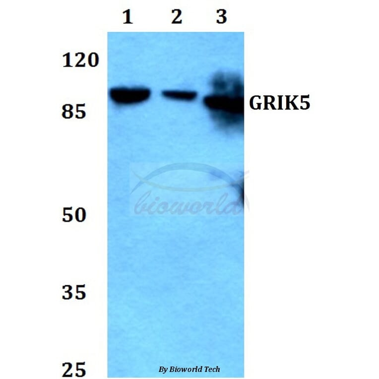 Anti-GRIK5 Antibody from Bioworld Technology (BS60292) - Antibodies.com