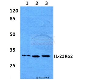 Anti-IL-22Rα2 Antibody from Bioworld Technology (BS60293) - Antibodies.com