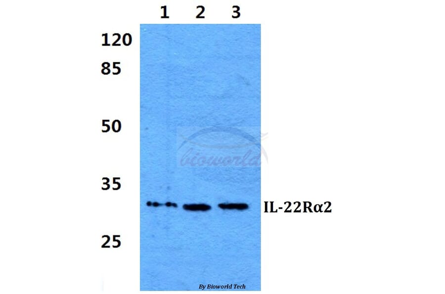 Anti-IL-22Rα2 Antibody from Bioworld Technology (BS60293) - Antibodies.com