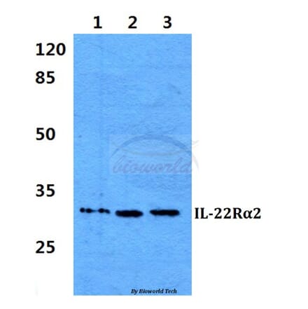 Anti-IL-22Rα2 Antibody from Bioworld Technology (BS60293) - Antibodies.com