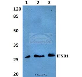 Anti-IFNB1 Antibody from Bioworld Technology (BS60295) - Antibodies.com