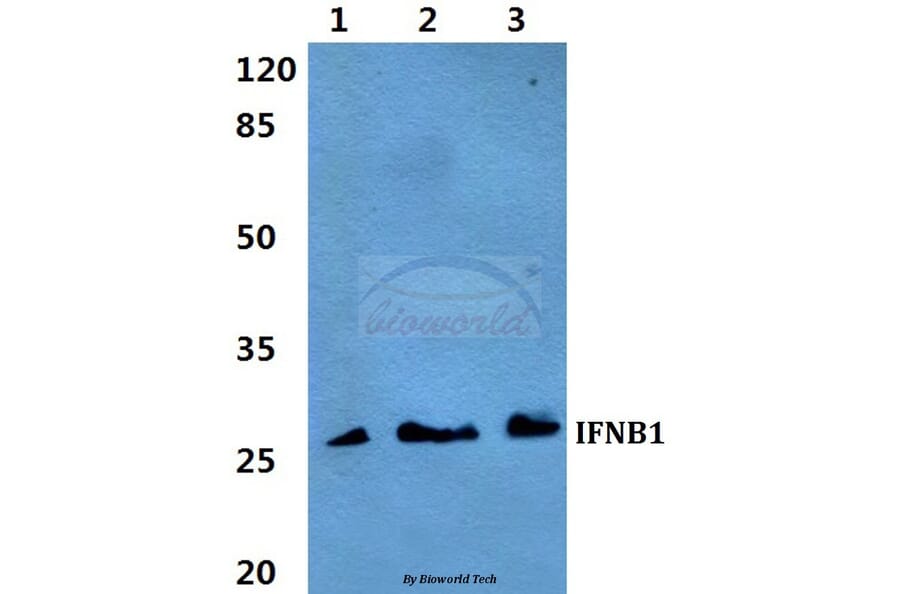 Anti-IFNB1 Antibody from Bioworld Technology (BS60295) - Antibodies.com